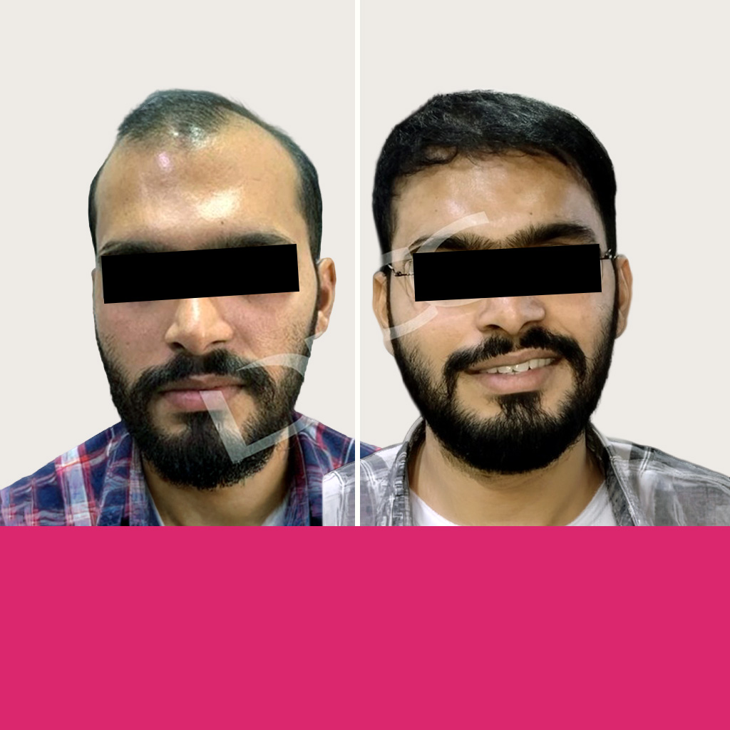 Jignesh Jariwala
